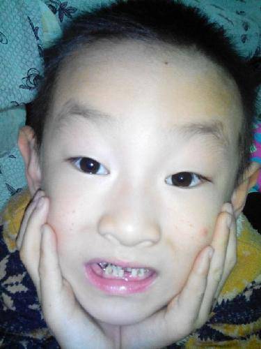 我们的小豁牙子记得《小屁孩日记》上说"不掉牙在小学生眼里是很丢脸